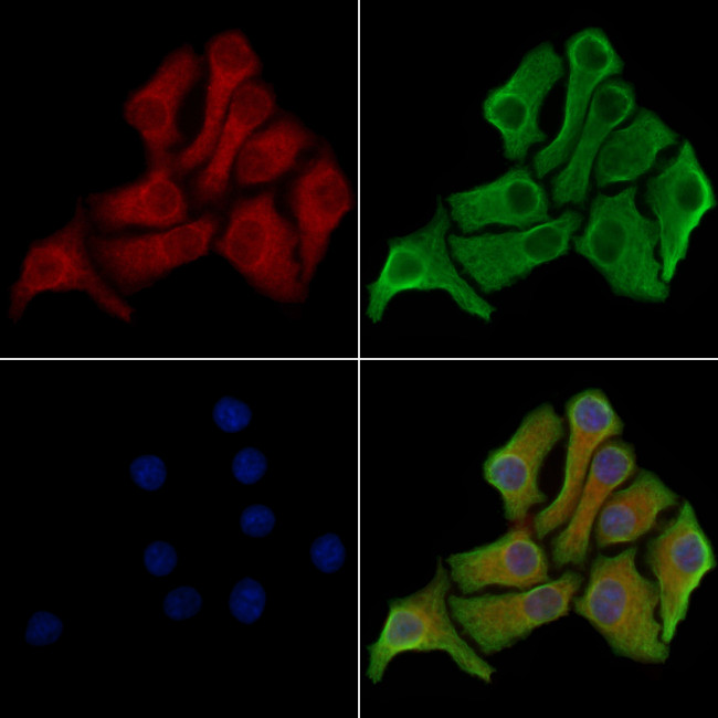 MLKL Antibody in Immunocytochemistry (ICC/IF)