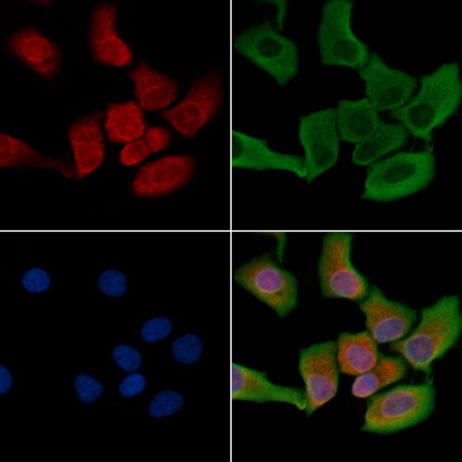 MMP1 Antibody in Immunocytochemistry (ICC/IF)