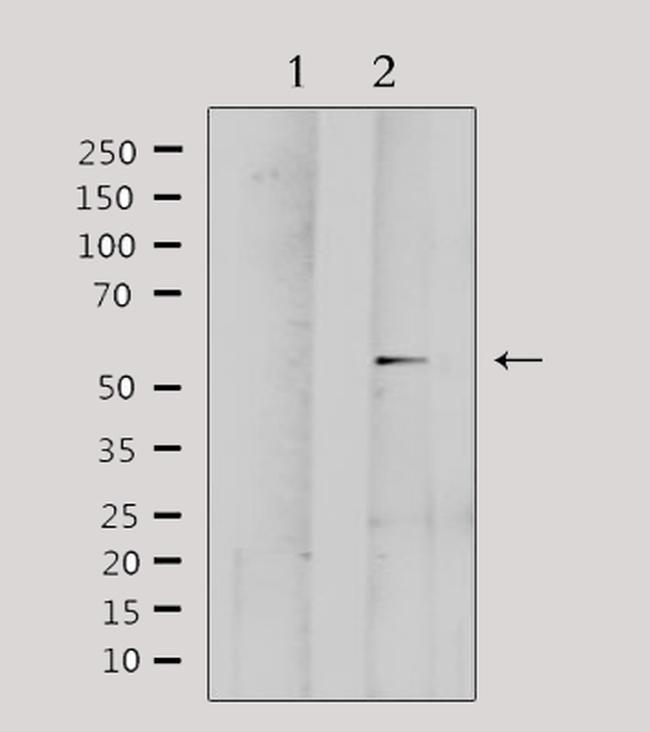 MMP1 Antibody in Western Blot (WB)