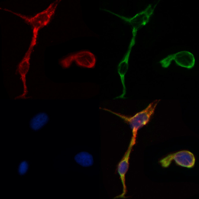 MMP2 Antibody in Immunocytochemistry (ICC/IF)