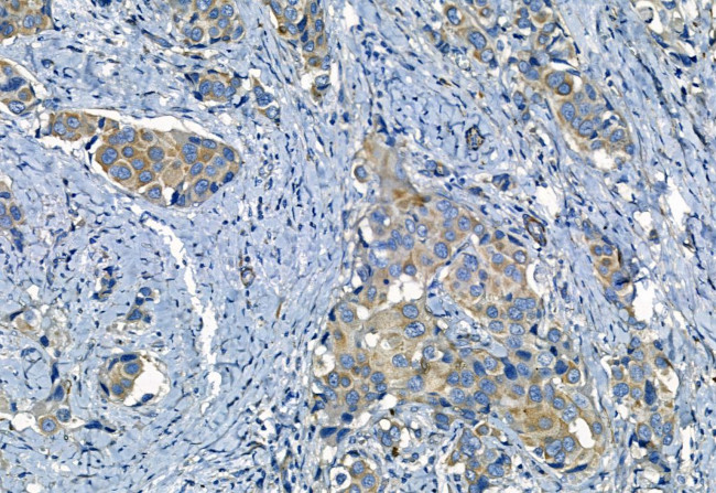 MMP2 Antibody in Immunohistochemistry (Paraffin) (IHC (P))