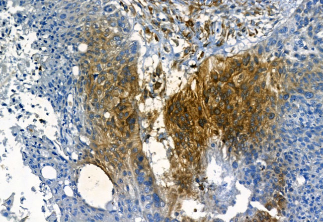 MMP2 Antibody in Immunohistochemistry (Paraffin) (IHC (P))