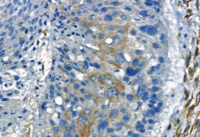 MMP2 Antibody in Immunohistochemistry (Paraffin) (IHC (P))