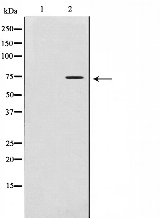 MMP2 Antibody in Western Blot (WB)