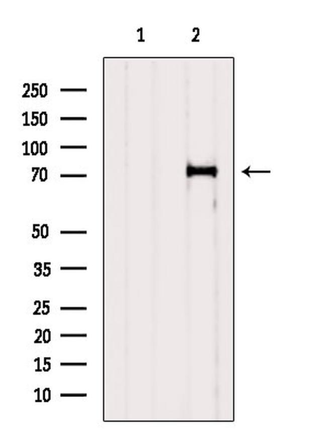 MMP2 Antibody in Western Blot (WB)