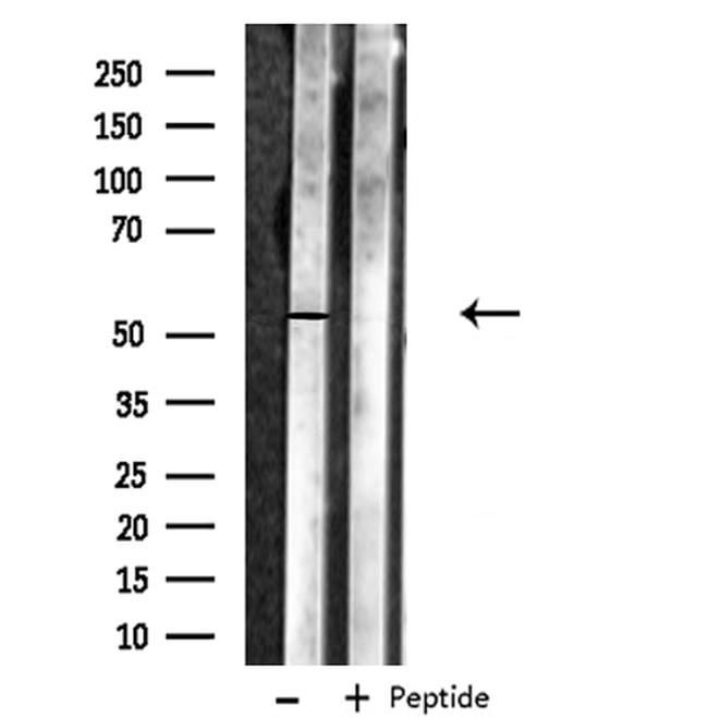 MNK1 Antibody in Western Blot (WB)