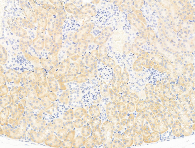 MOV10 Antibody in Immunohistochemistry (Paraffin) (IHC (P))