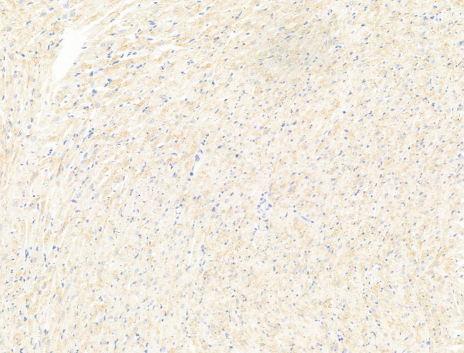 MOV10 Antibody in Immunohistochemistry (Paraffin) (IHC (P))