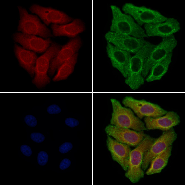 MSH4 Antibody in Immunocytochemistry (ICC/IF)