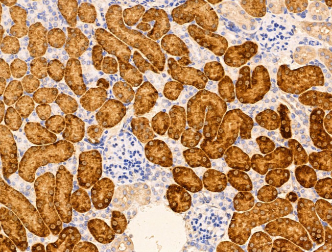 MSH4 Antibody in Immunohistochemistry (Paraffin) (IHC (P))