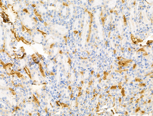 MSH4 Antibody in Immunohistochemistry (Paraffin) (IHC (P))