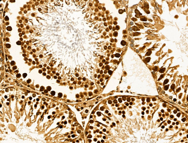 MSH4 Antibody in Immunohistochemistry (Paraffin) (IHC (P))