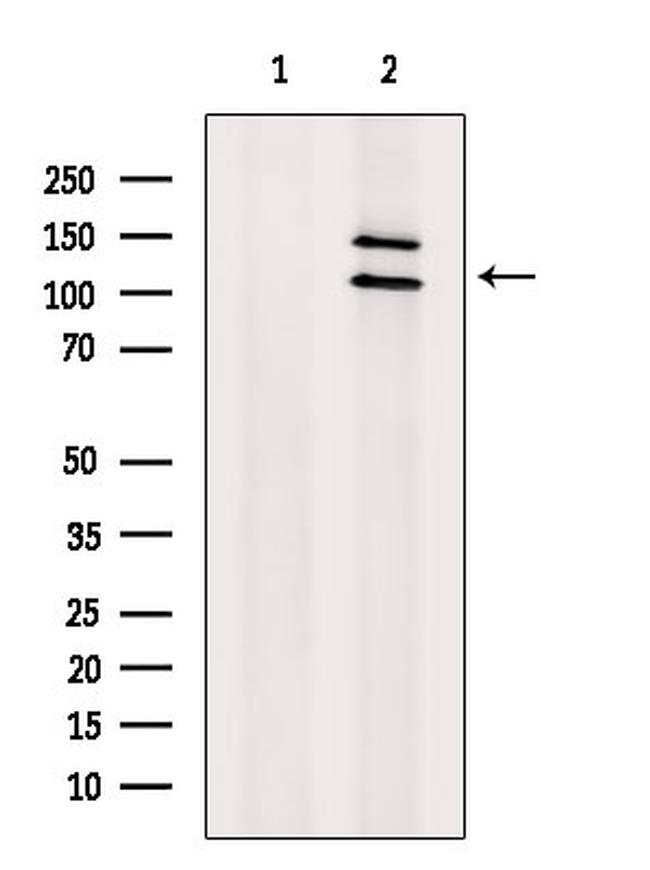 MSH4 Antibody in Western Blot (WB)