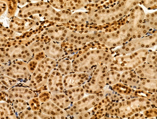 MTA1 Antibody in Immunohistochemistry (Paraffin) (IHC (P))