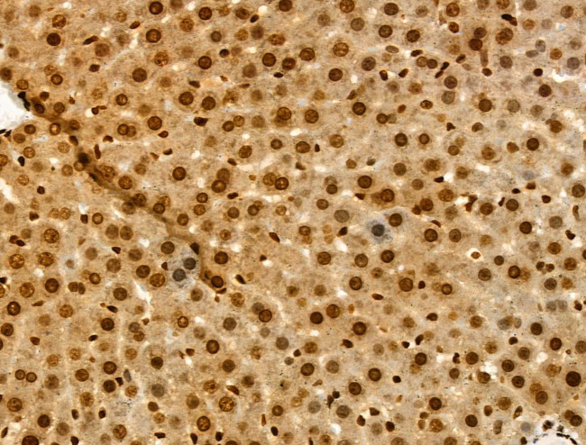 MTA1 Antibody in Immunohistochemistry (Paraffin) (IHC (P))