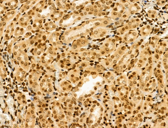 MTA1 Antibody in Immunohistochemistry (Paraffin) (IHC (P))