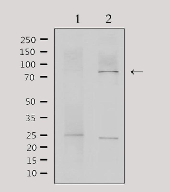 MTA1 Antibody in Western Blot (WB)