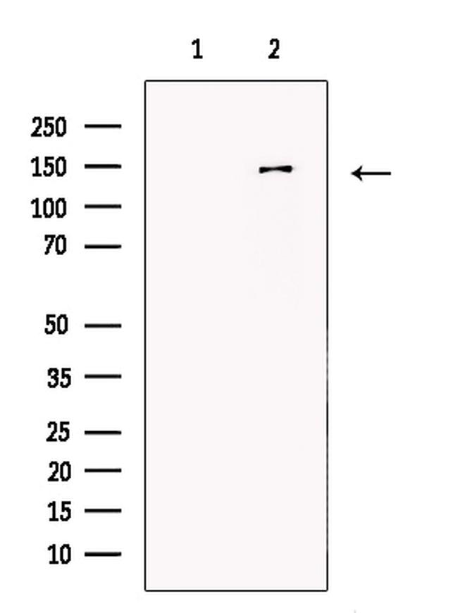 MTR Antibody in Western Blot (WB)