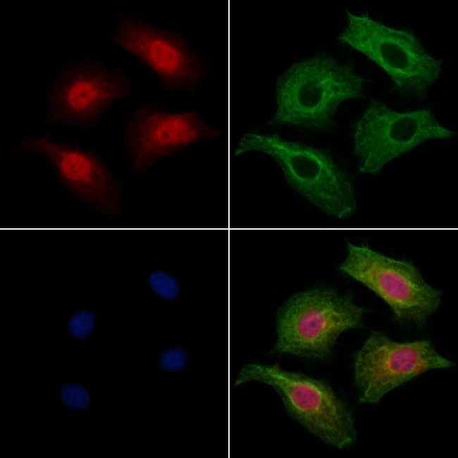 MTUS1 Antibody in Immunocytochemistry (ICC/IF)