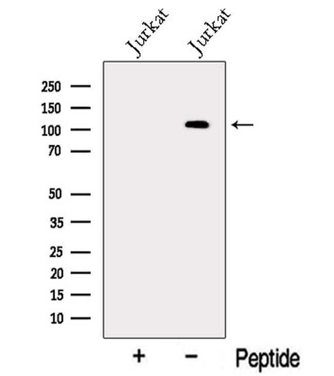 MTUS1 Antibody in Western Blot (WB)