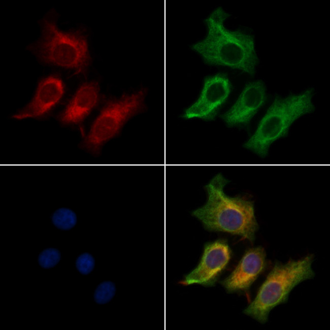 CRYM Antibody in Immunocytochemistry (ICC/IF)