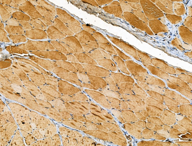 CRYM Antibody in Immunohistochemistry (Paraffin) (IHC (P))