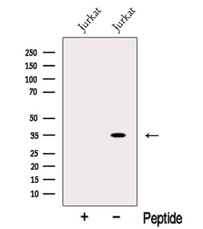 CRYM Antibody in Western Blot (WB)