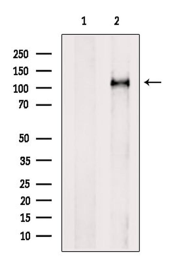 MVP Antibody in Western Blot (WB)