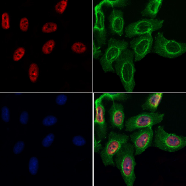 MYF5 Antibody in Immunocytochemistry (ICC/IF)