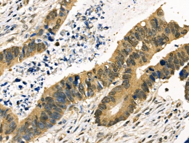 MYF5 Antibody in Immunohistochemistry (Paraffin) (IHC (P))