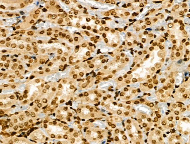 MYST2 Antibody in Immunohistochemistry (Paraffin) (IHC (P))