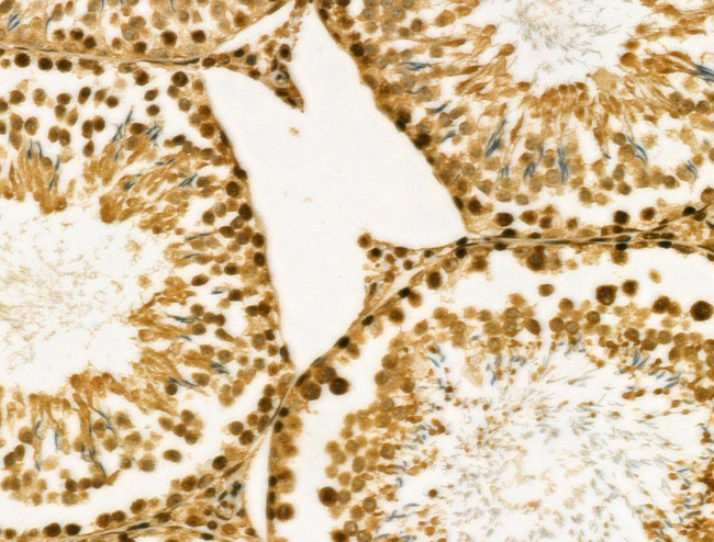 MYST2 Antibody in Immunohistochemistry (Paraffin) (IHC (P))