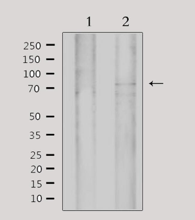 MYST2 Antibody in Western Blot (WB)