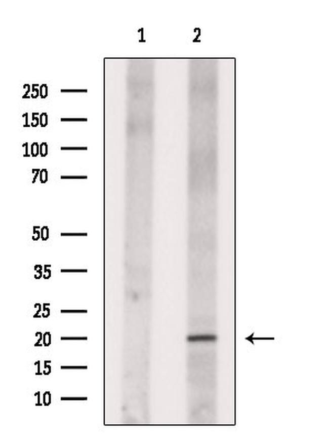 NANOS3 Antibody in Western Blot (WB)