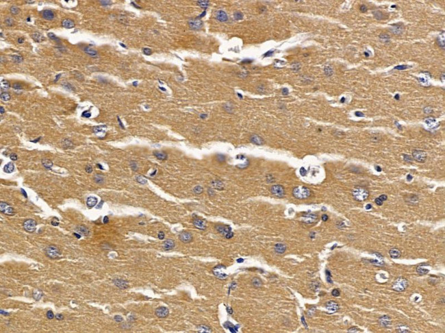 NAT14 Antibody in Immunohistochemistry (Paraffin) (IHC (P))