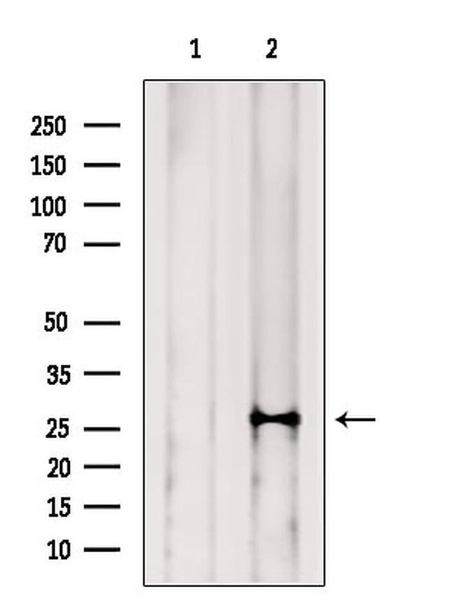 NAT14 Antibody in Western Blot (WB)