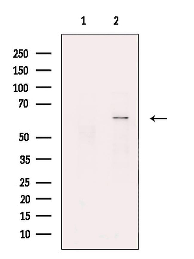 NPR3 Antibody in Western Blot (WB)