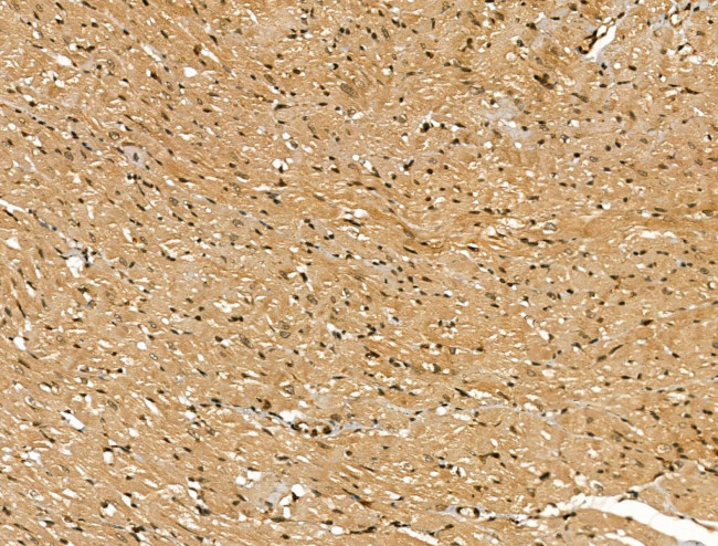 SCN5A Antibody in Immunohistochemistry (Paraffin) (IHC (P))