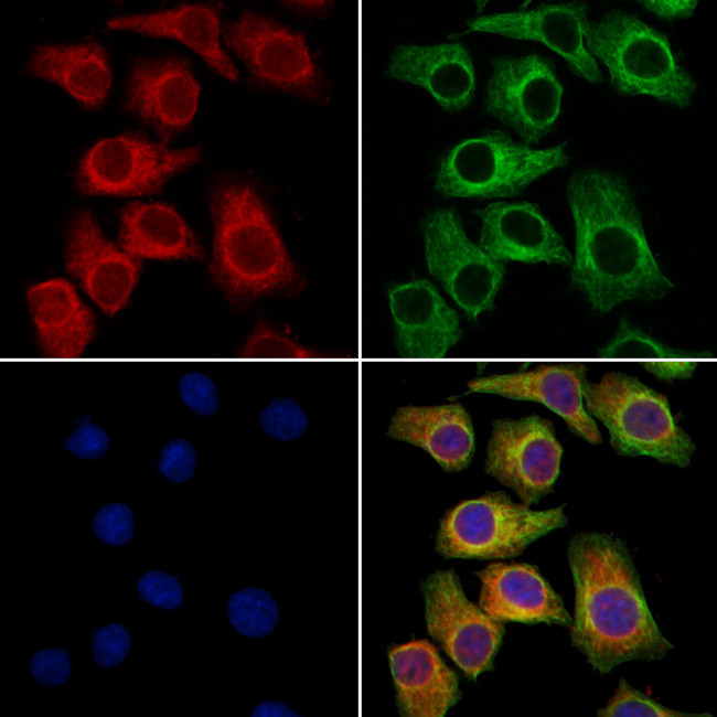 SCN10A Antibody in Immunocytochemistry (ICC/IF)