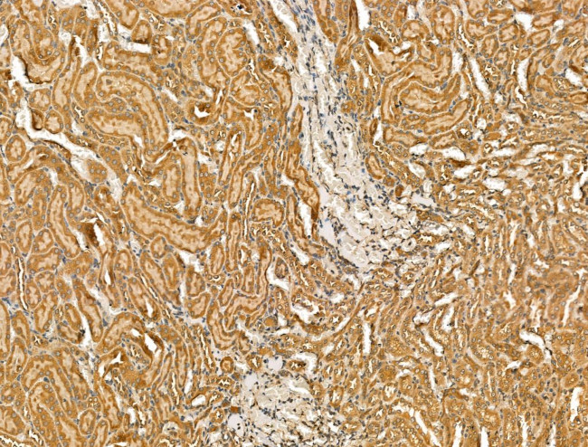 SCN10A Antibody in Immunohistochemistry (Paraffin) (IHC (P))