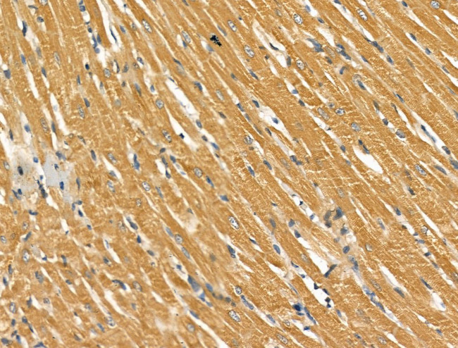 SCN10A Antibody in Immunohistochemistry (Paraffin) (IHC (P))