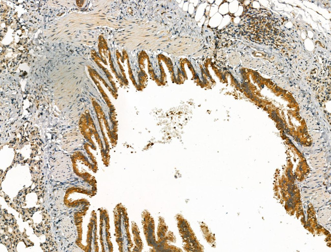 SCN10A Antibody in Immunohistochemistry (Paraffin) (IHC (P))