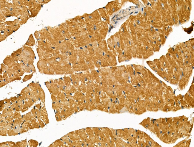 SCN10A Antibody in Immunohistochemistry (Paraffin) (IHC (P))