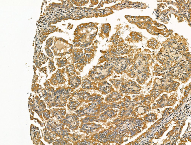 SCN10A Antibody in Immunohistochemistry (Paraffin) (IHC (P))