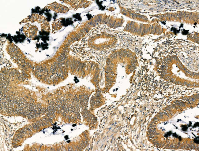 SCN10A Antibody in Immunohistochemistry (Paraffin) (IHC (P))