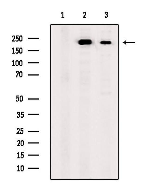 SCN10A Antibody in Western Blot (WB)