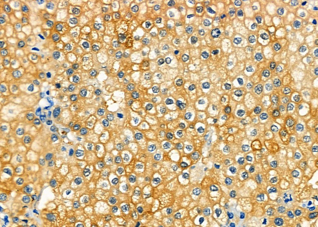 CD56 Antibody in Immunohistochemistry (Paraffin) (IHC (P))