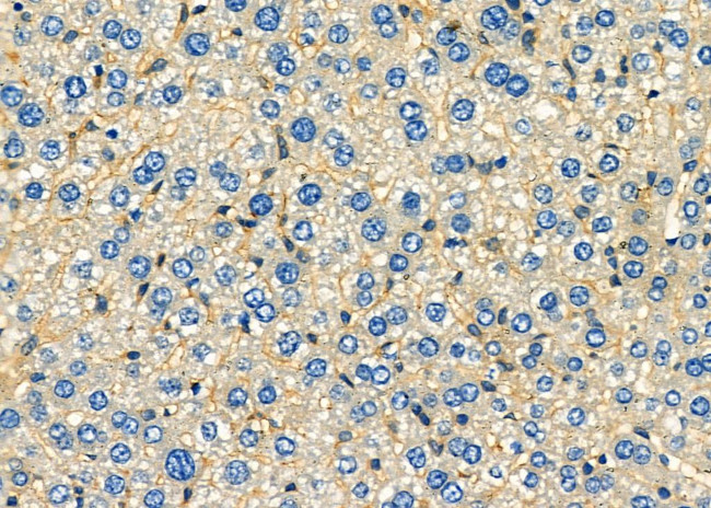 CD56 Antibody in Immunohistochemistry (Paraffin) (IHC (P))