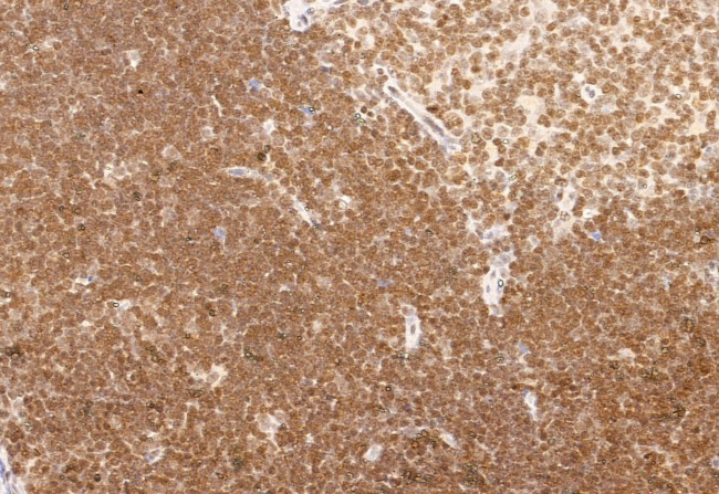 NCOA4 Antibody in Immunohistochemistry (Paraffin) (IHC (P))