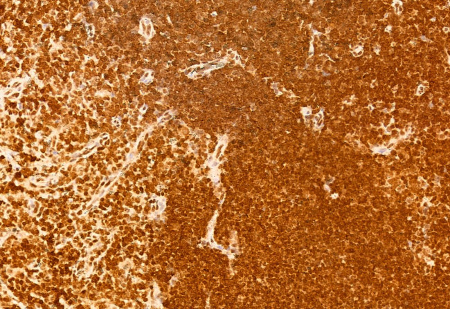 NCOA4 Antibody in Immunohistochemistry (Paraffin) (IHC (P))